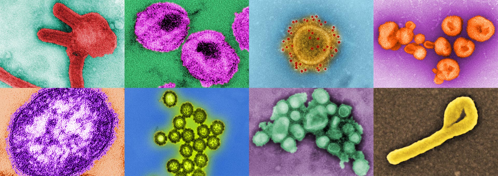 Digitally-colorized TEM images from CDC-PHIL.