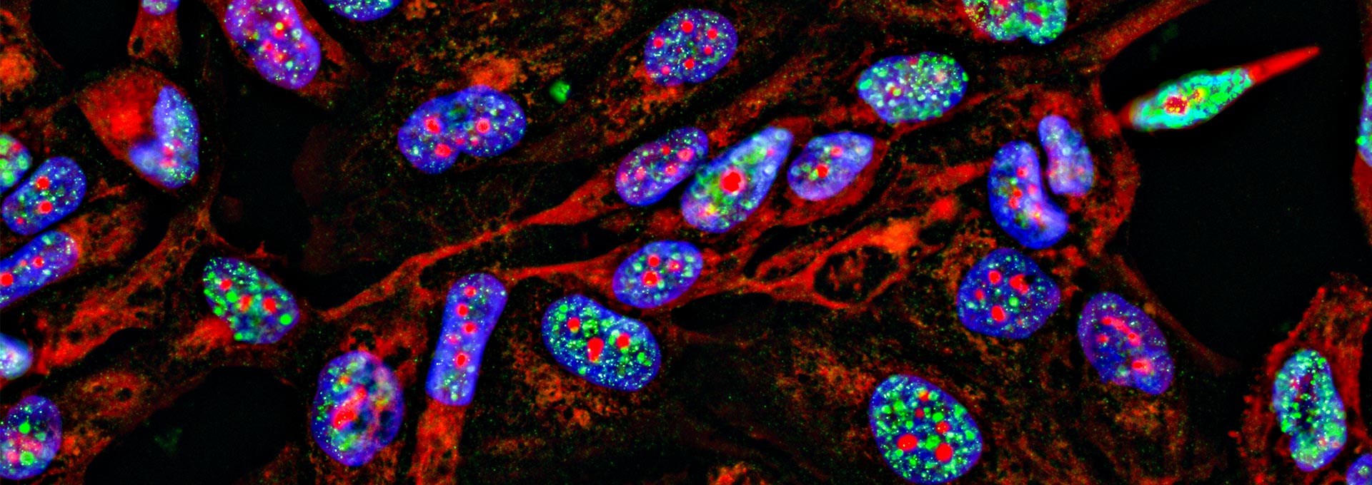 Fluorescent Imaging immunofluorescence of cancer cells growing in 2D