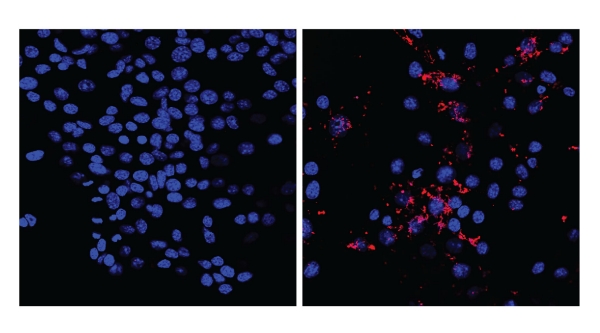 Macropinocytosis