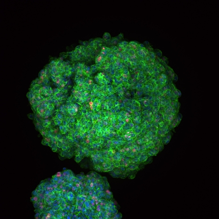 Image of a mammary tumor organoid