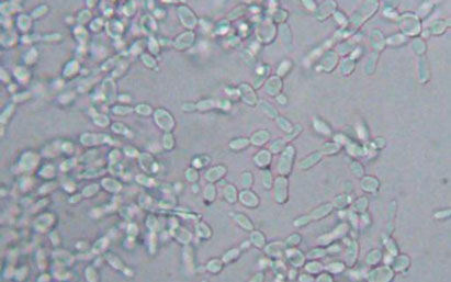 Yeast cells 