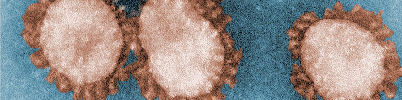 Digitally-colorized TEM image from CDC-PHIL.