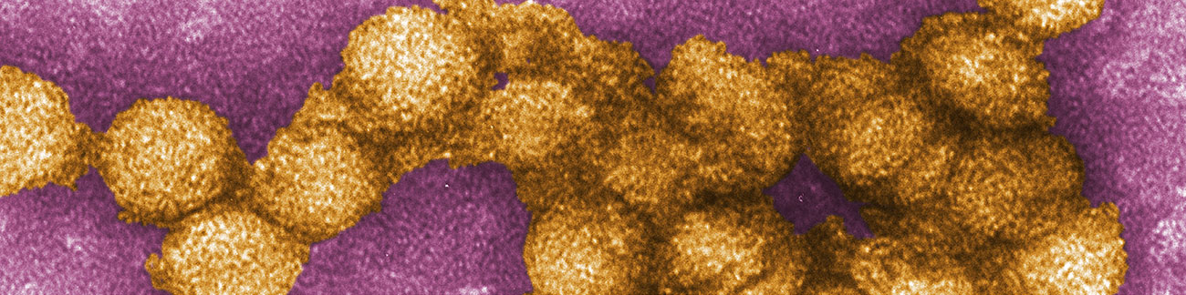 Digitally-colorized TEM image from CDC-PHIL.