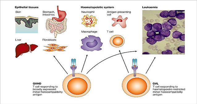 Separating the graft-versus-leukaemia effect from graft-versus-host disease