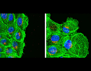 Collective migration of normal MCF10A cells (left) and MCF10A cells with reduced levels of Cul5, an obligate subunit of CRL5 (right)