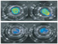 Tumor slices as a robust pre-clinical platform