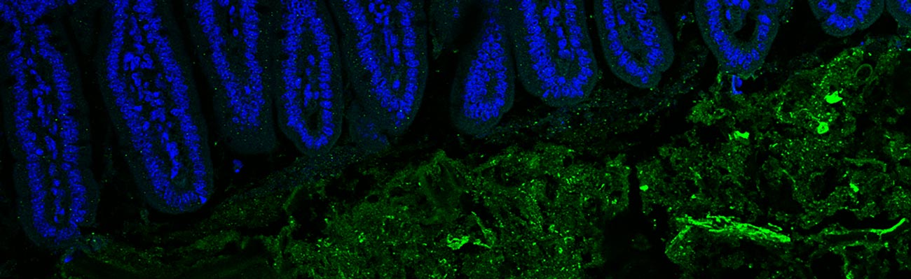 Serum IgG3 (green) binds to gut microbes. DAPI (blue) indicates nuclei of mouse epithelial cells. 