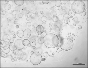 Image of pancreatic cancer organoids growing in 3D culture