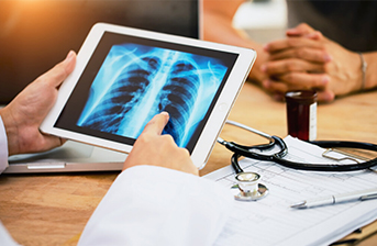 chest x-ray