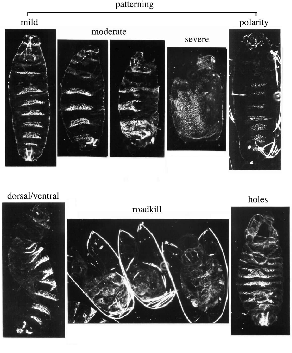 cuticle phenotypes