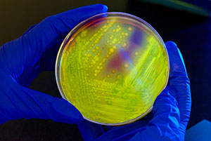 Researcher handling a petri dish