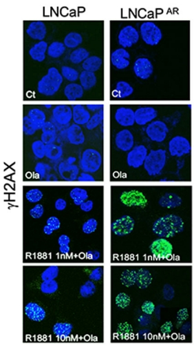 Image of supraphysiological androgens and the PARP inhibitor olaparib