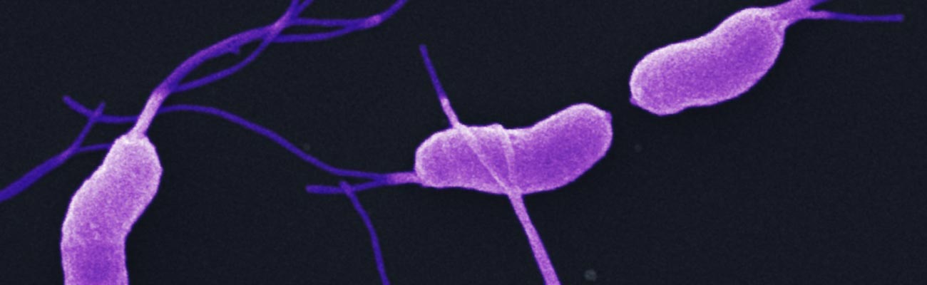 False-colored scanning electron micrograph of Helicobacter pylori bacteria, showing helical cell shape and flagella.