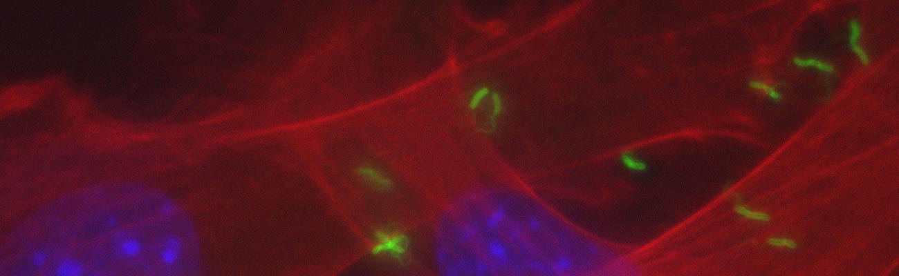 Mouse gastric epithelial cells and wild-type Helicobacter pylori bacteria.