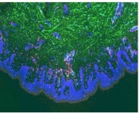 HSV-2 infection micro environments