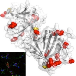 Disposal of iron by a mutant form of lipocalin 2