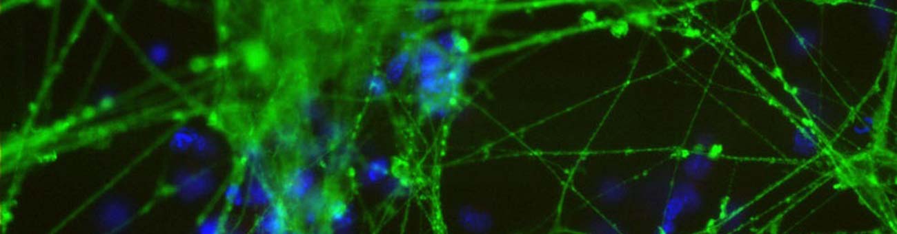 Expression of the NeuroD2 transcription factor in mouse embryonal carcinoma cells induces differentiation into neurons