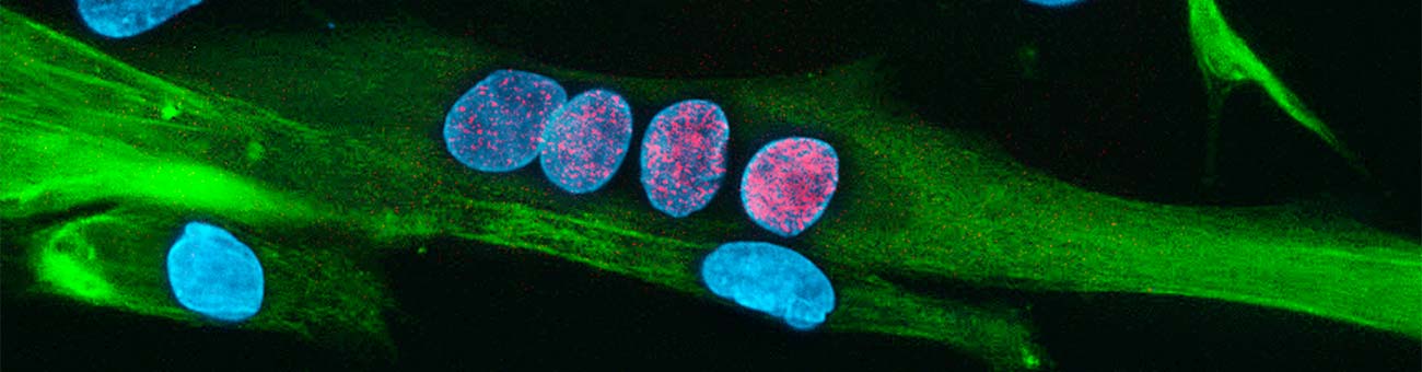 Endogenous expression of the DUX4 transcription factor in cultured FSHD muscle cells