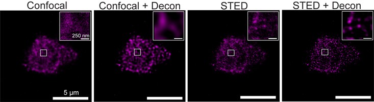 image of: STED Comparison