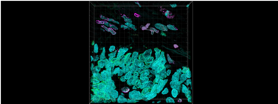 Missegregating chromosome anaphase