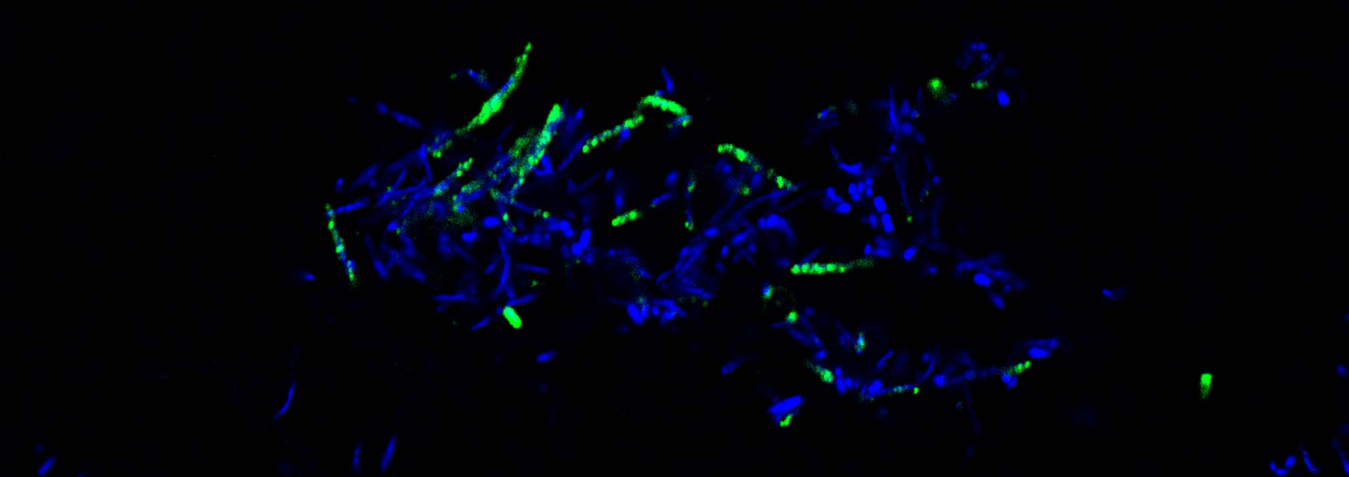 Maternal IgG2b (green) coats microbes present in offspring gut. DAPI (blue) indicates nuclei of bacteria in mouse ileum.