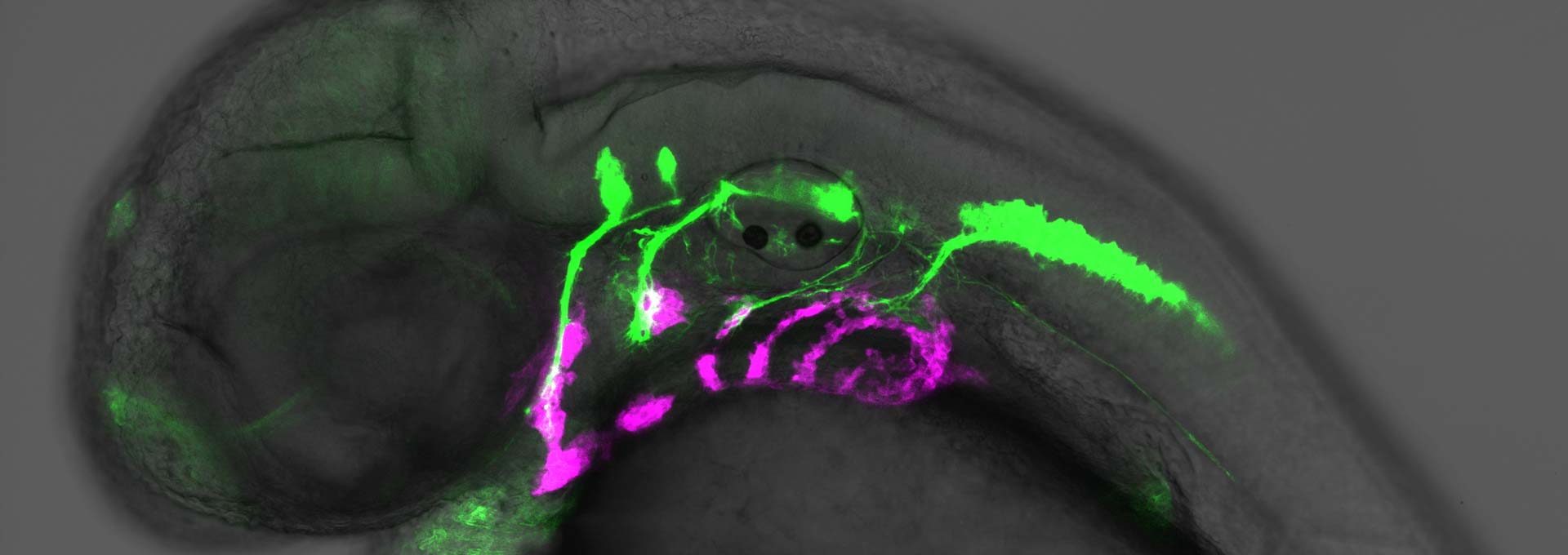 Side view of 36-hour old zebrafish embryo 